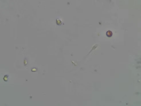 Semen Leukocyte Staining Solution (Peroxidase Assay) - sperminfo andrology product image 2
